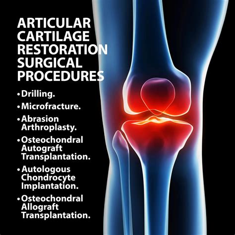 Strategies for Articular Cartilage Repair and Regeneration