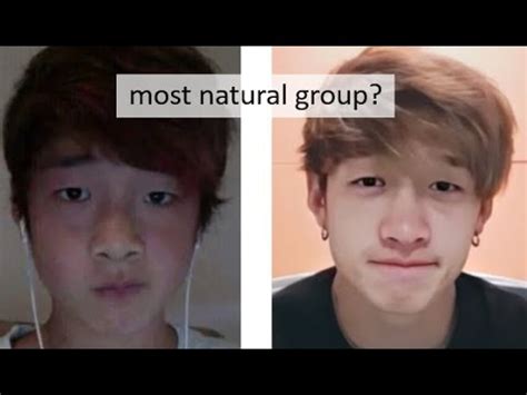 Stray kids plastic surgery. Since stars who have undergone plastic surgery often find themselves facing criticism and scrutiny, many K-Pop idols choose to keep quiet about their procedures. These 9 idols, however, boldly confessed to having nose jobs (also known as rhinoplasty). 