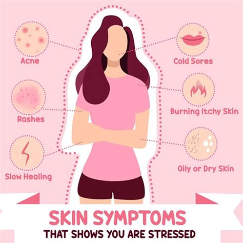 Stress related skin conditions. .  <a href=https://algaith.b2cdomain.in/6...