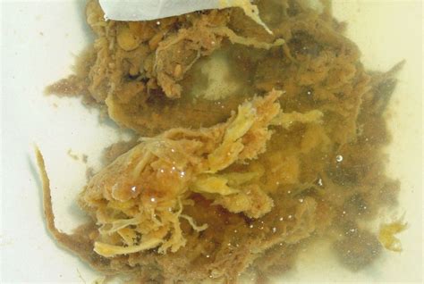Stringy candida in stool. the white mucous and stringy like substance sounds like candida to me... it is a fungus due to diet, antibiotics and stress (one or all). remove all sugar from diet, lots of water and but Threelac to treat the overgrowth of bad flora in the intestine. 