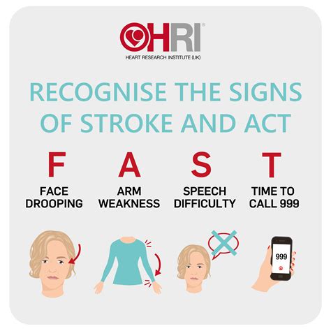 Stroke Signs Photos and Premium High Res Pictures - Getty Images