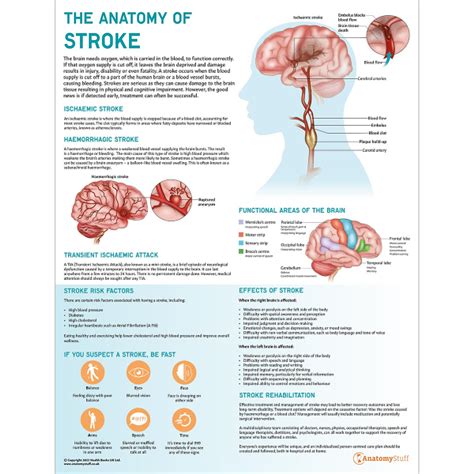 Stroke picture. Things To Know About Stroke picture. 