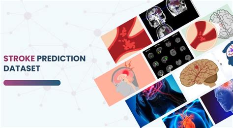 Stroke prediction dataset csv.  This dataset is designed for researchers ...