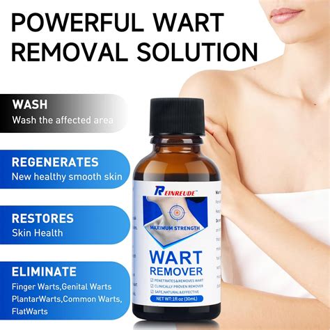 Strongest wart remover at home. .  ...