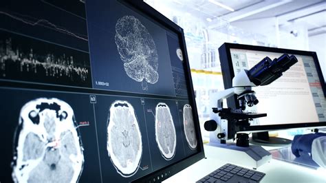 Study Identifies Potential Biomarker for SPMS Everyday Health