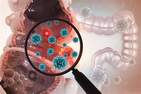 Study Patients Prefer Stool Test to Colonoscopy