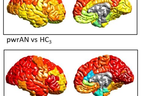 Study Reveals Roots of OCD - Neuroscience News