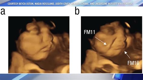 Study shows unborn babies can taste in the womb