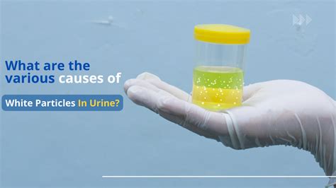 Often, these white stuff floating in urine or white discharge cause your …