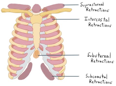 Substernal definition of substernal by Medical dictionary