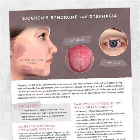 Suffering with Sjogrens Sjogren