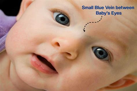 Sugar bug vein & MTHFR??? - October 2024 Babies - What to Expect