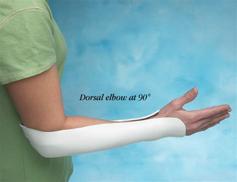 Sugar tong splint cpt. If the same splint was made for a 25-year-old, you would use code Q4022, “Cast supplies, short arm splint, adult (11 years +), fiberglass.” In both cases, you would also assign CPT code 29125, “Application of short arm splint (forearm to hand); static” because the codes for application and strapping are not age-dependent. Q. 