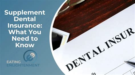 Supplemental dental insurance illinois. Things To Know About Supplemental dental insurance illinois. 