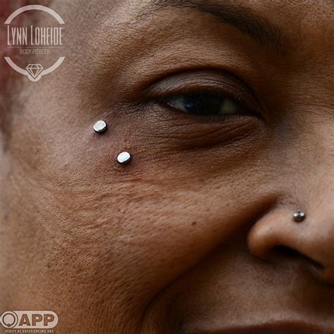 Surface to surface piercing. Irrigating the surface of the piercing is a good way to remove dirt and bacteria from around the wound, but with surface piercings and anchors the majority of the healing is taking … 