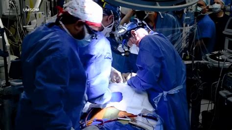 Surgeons transplant a pig heart into a dying man