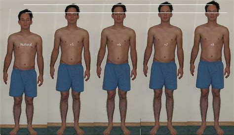 Surgery to shrink height. Things To Know About Surgery to shrink height. 