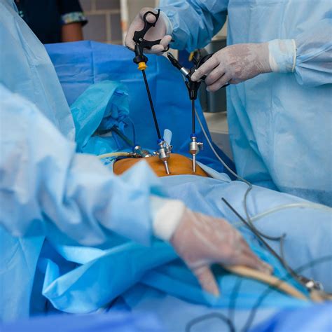 Surgical Endoscopy and Minimally Invasive Surgery …