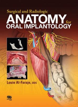 Full Download Surgical And Radiologic Anatomy For Oral Implantology By Louie Alfaraje