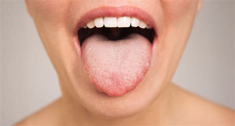 Svamp på tungan 1177