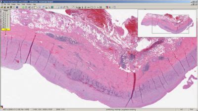 Svs viewer online.  ImageScope is also used in conjunction with the Aperio...
