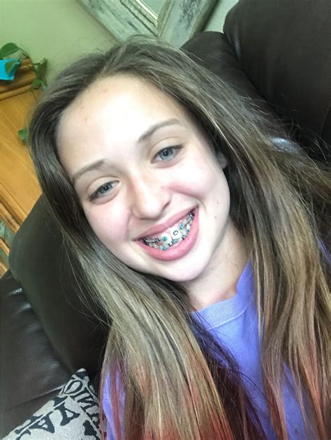 Sweet braces nude.  https://petite18. com//flashgalleries/flash/index. ...