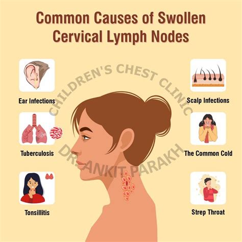 Swollen Posterior Cervical Lymph Nodes: Causes, …