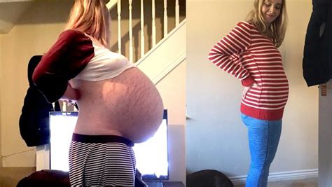 TheBellyGirl on DeviantArt https://wwwcom/thebellygirl/art/Mel-s-Chubby-Belly-Noises-945464215 TheBellyGirl A TEENAGER was stunned to find out why her stomach had ballooned out as if she was heavily pregnant. . 