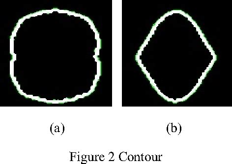 Symmetry Auto-detection Based on Contour and Corner Models