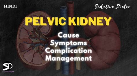 Symptoms, Causes And Treatment For Floating Kidney