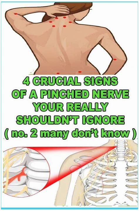 Symptoms of Pinched Nerve in Neck - Health Hearty