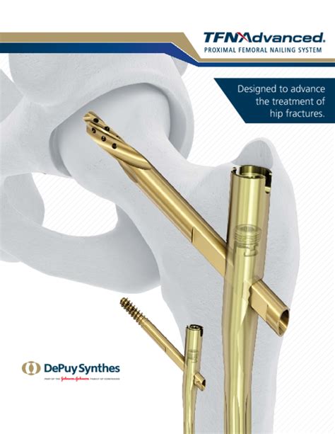 1. DePuy Synthes Biomechanical Evaluation of Non-Augme
