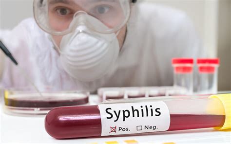 Syphilis and other STDs are on the rise. States lost millions of dollars to fight and treat them
