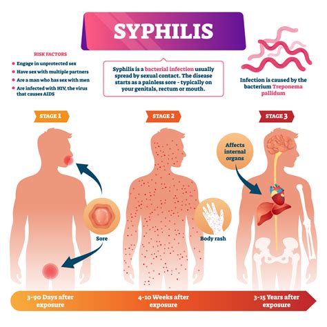 Syphilis how is it spread