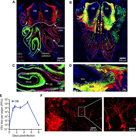 T cell engagement of cross-presenting microglia protects the