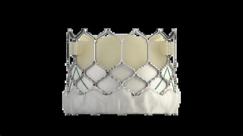 TAVR with the SAPIEN 3 Valve See the Clinical Difference