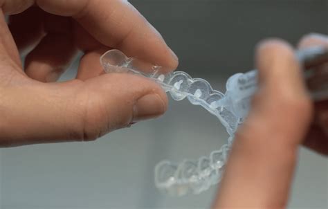 Teeth whitening: How to do it safely at home - Yahoo Life - balustradellc