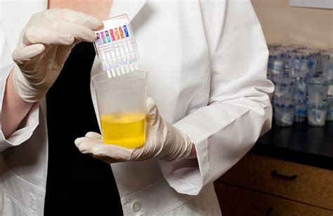 Teknik Tes Narkoba - Alomedika - wintechmobiles.com