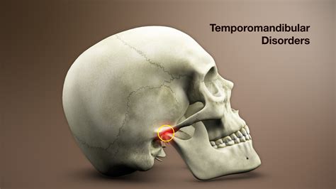 TEMPOROMANDIBULAR JOINT …