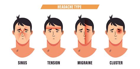Tension Headache: What It Is, Causes, Symptoms - balustradellc