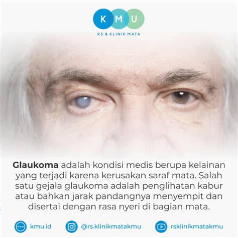 Terapi Glaukoma Pada Mata Terdekat Di Klaten Ini yang ... - balustradellc