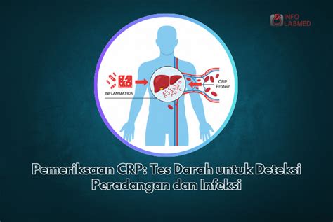 Tes Darah untuk Deteksi Campak - wintechmobiles.com