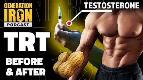 Testosterone replacement is booming – I asked experts how to naturally ... - balustradellc