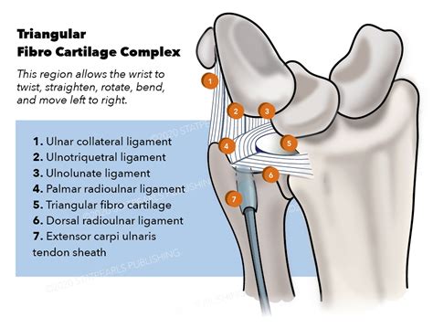 TFCC (Triangular Fibrocartilage Complex) Tears