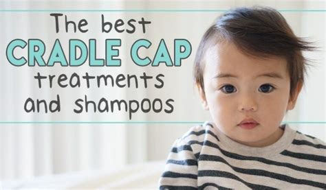 The 5 Best Cradle Cap Treatments And Shampoos - balustradellc