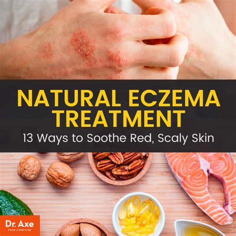The Best Home Remedies for Eczema - Cleveland … - balustradellc