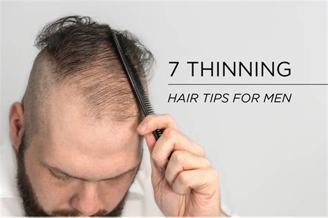 The Best Thinning Hair Tips for Men | MenScience - balustradellc