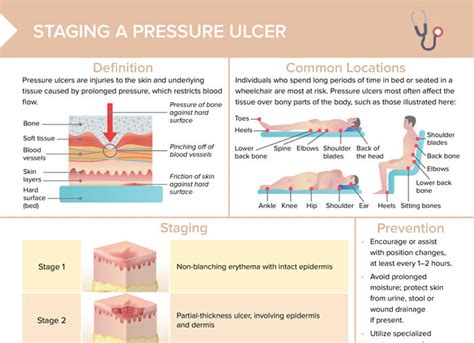 The Effects of Linen Layers on Pressure Ulcer ... - ResearchGate - raincitystudios.com