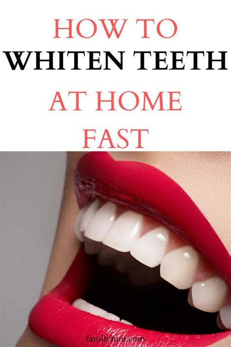 The Fastest Way to Whiten Your Teeth Naturally - balustradellc
