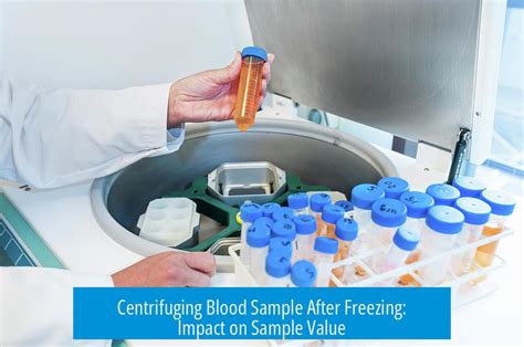 The Importance of Centrifuging Blood Samples: Risks and Benefits for ... - wintechmobiles.com